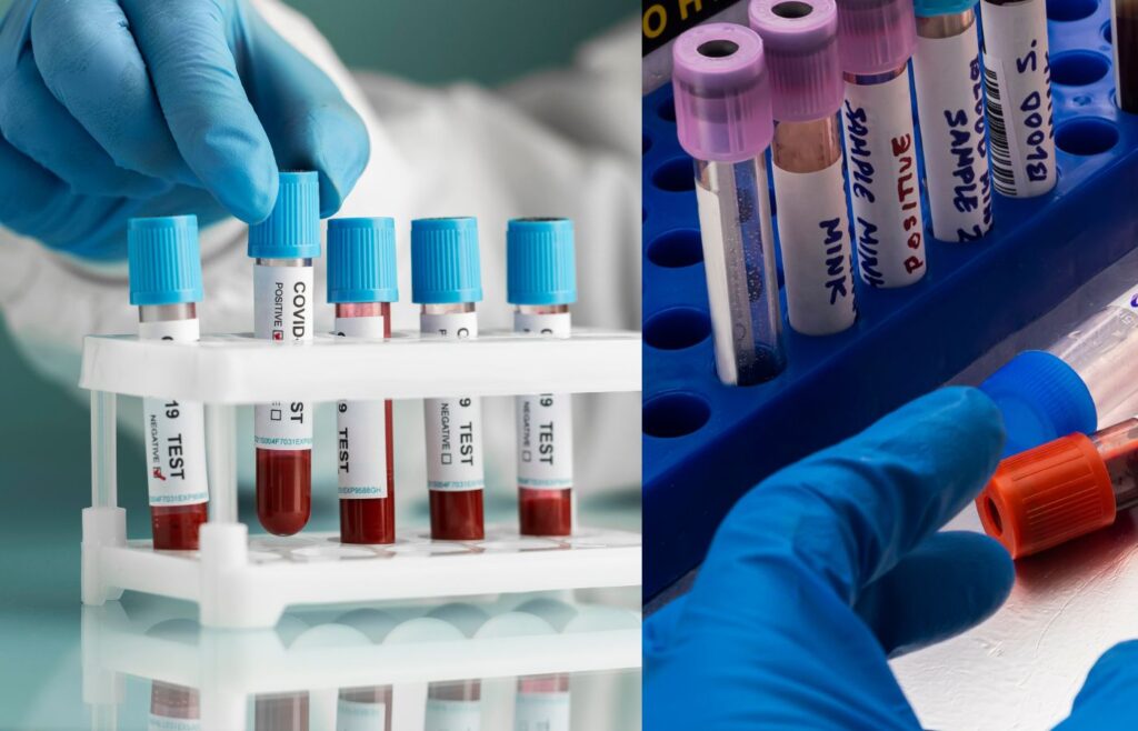Students Prefer Our Paramedical Institute for Pathology Training